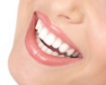 /album/photo-gallery-homepage1/beautiful-white-smile-jpg1/